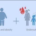 stunting dan overnutrisi